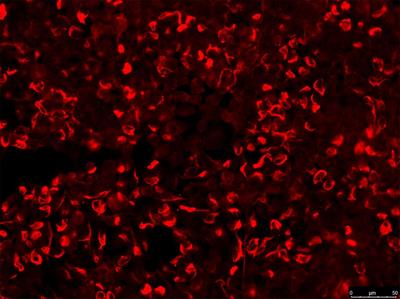 Clinical characteristics and prognostic factors for short-term outcomes of autoimmune glial fibrillary acidic protein astrocytopathy: a retrospective analysis of 33 patients